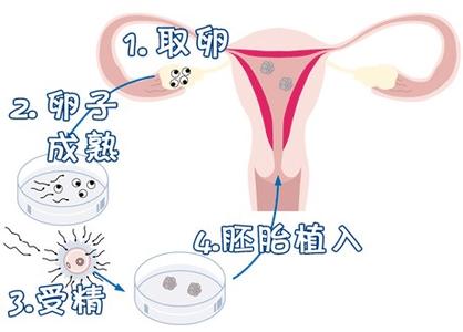 关于景泰生殖